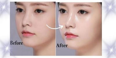 Korean Glass Skin Glow Serum, 30 Ml